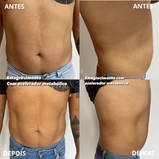 Emagrecimento (4)