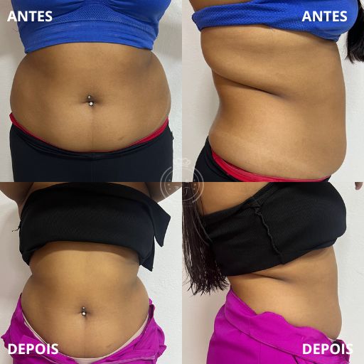 Emagrecimento (5)